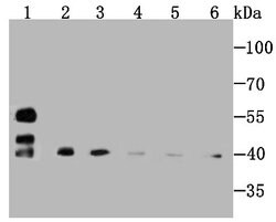 SMYD3 Rabbit anti-Human, Mouse, Rat, Clone: JM73-63, Novus Biologicals